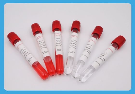 5ml نمونه موضوع خاص لوله اتیلن اکسید